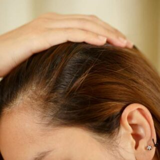 Psoriasis hair treatment